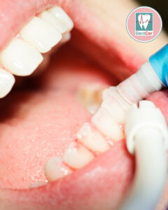 O QUE ACONTECE DURANTE UMA SESSÃO DE LIMPEZA DENTÁRIA? PASSO A PASSO PARA PERDER O MEDO E CUIDAR DO SEU SORRISO